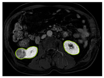 Diagnostics 15 01636 i009