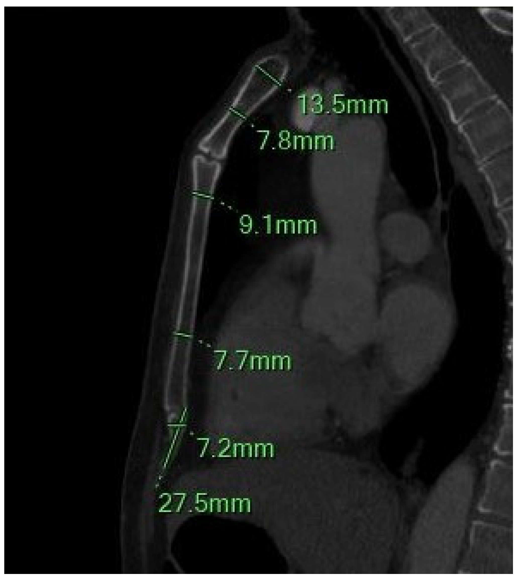 Diagnostics 15 01649 g002