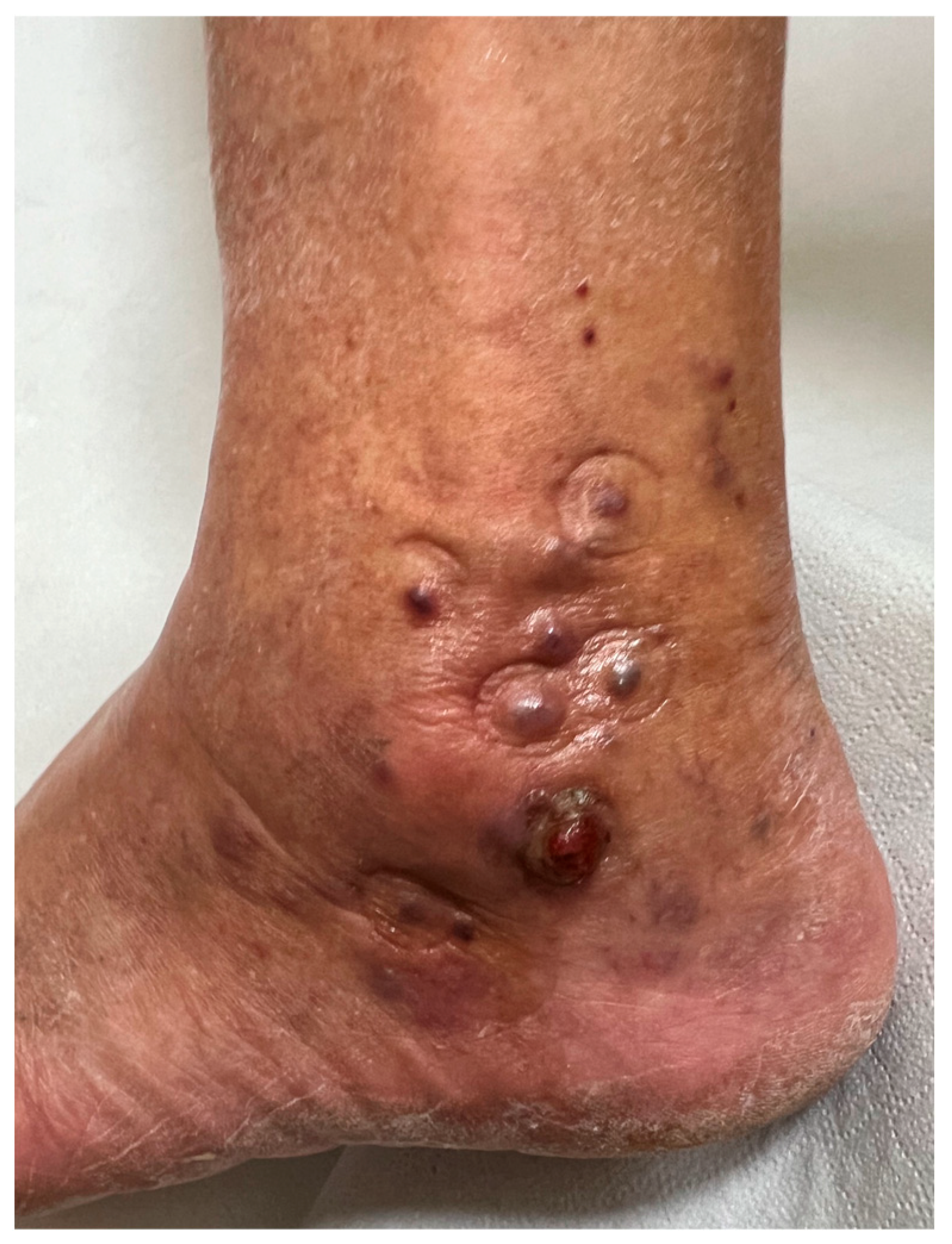 Diagnostics 15 01665 g001