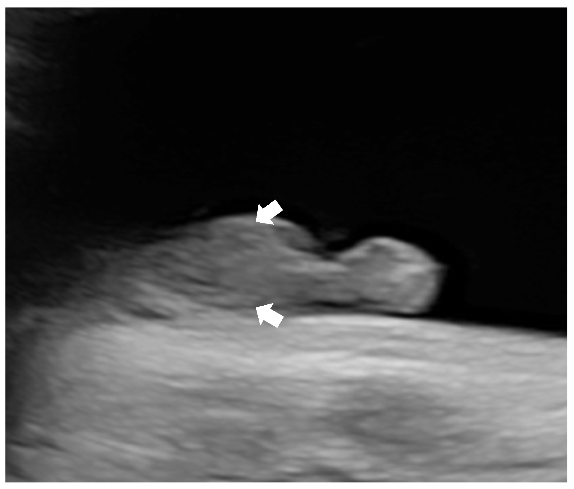 Diagnostics 15 01666 g002 Diagnostics 15 01666 g002
