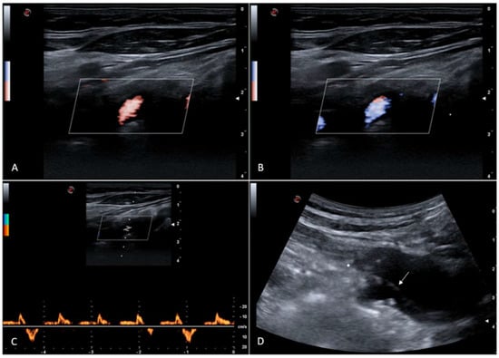 Diagnostics 15 01668 g001