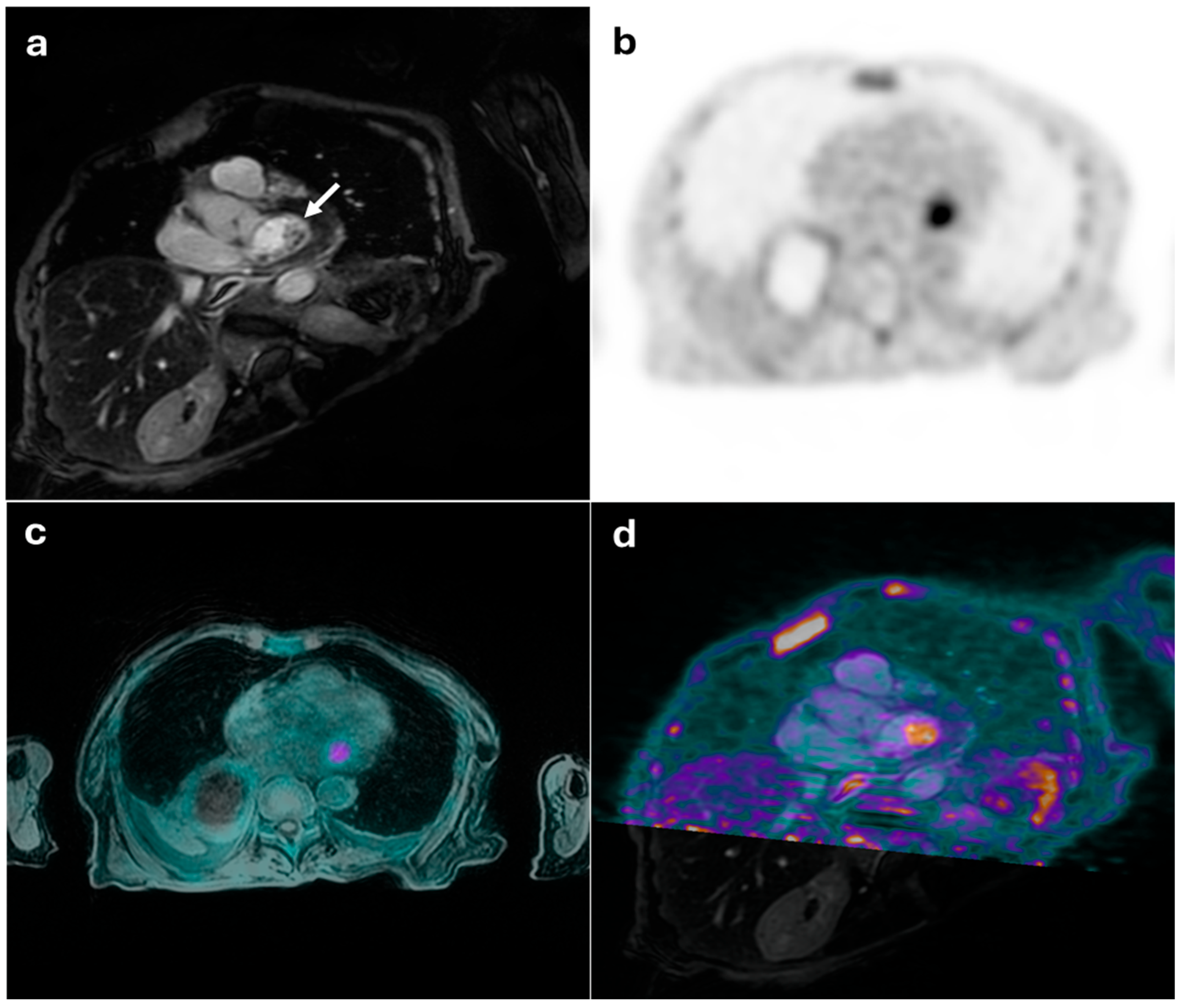Diagnostics 15 01670 g001