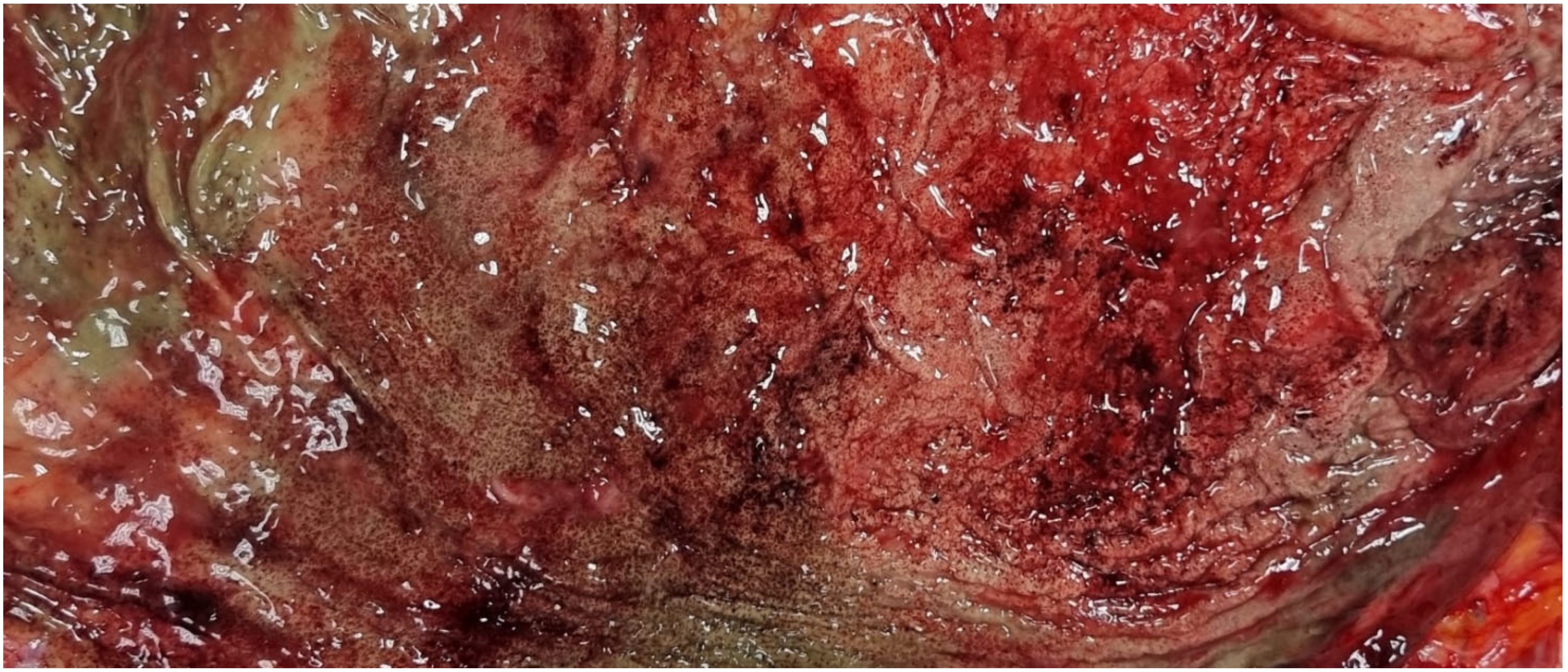 Diagnostics 15 01673 g004