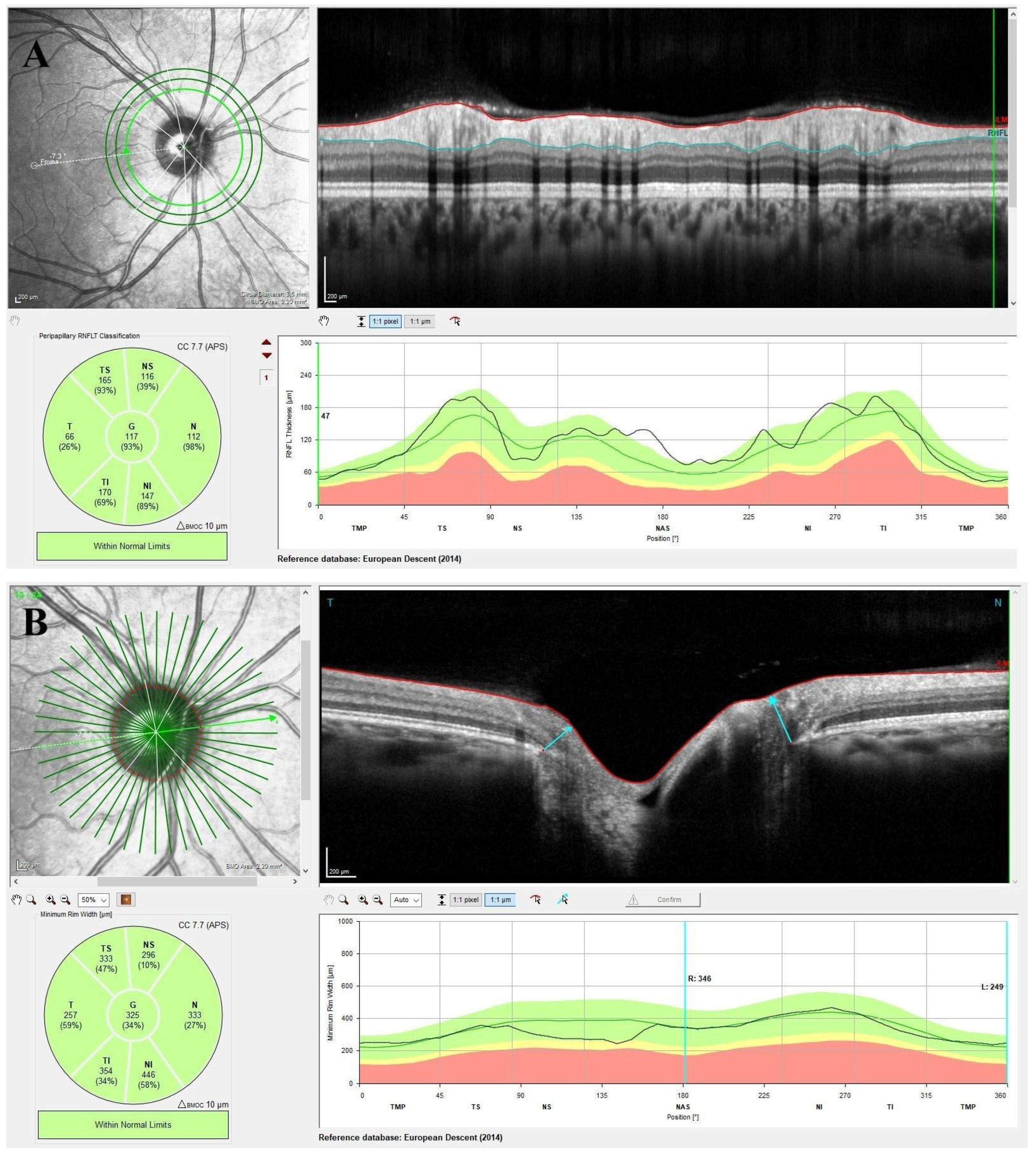 Diagnostics 15 01682 g002