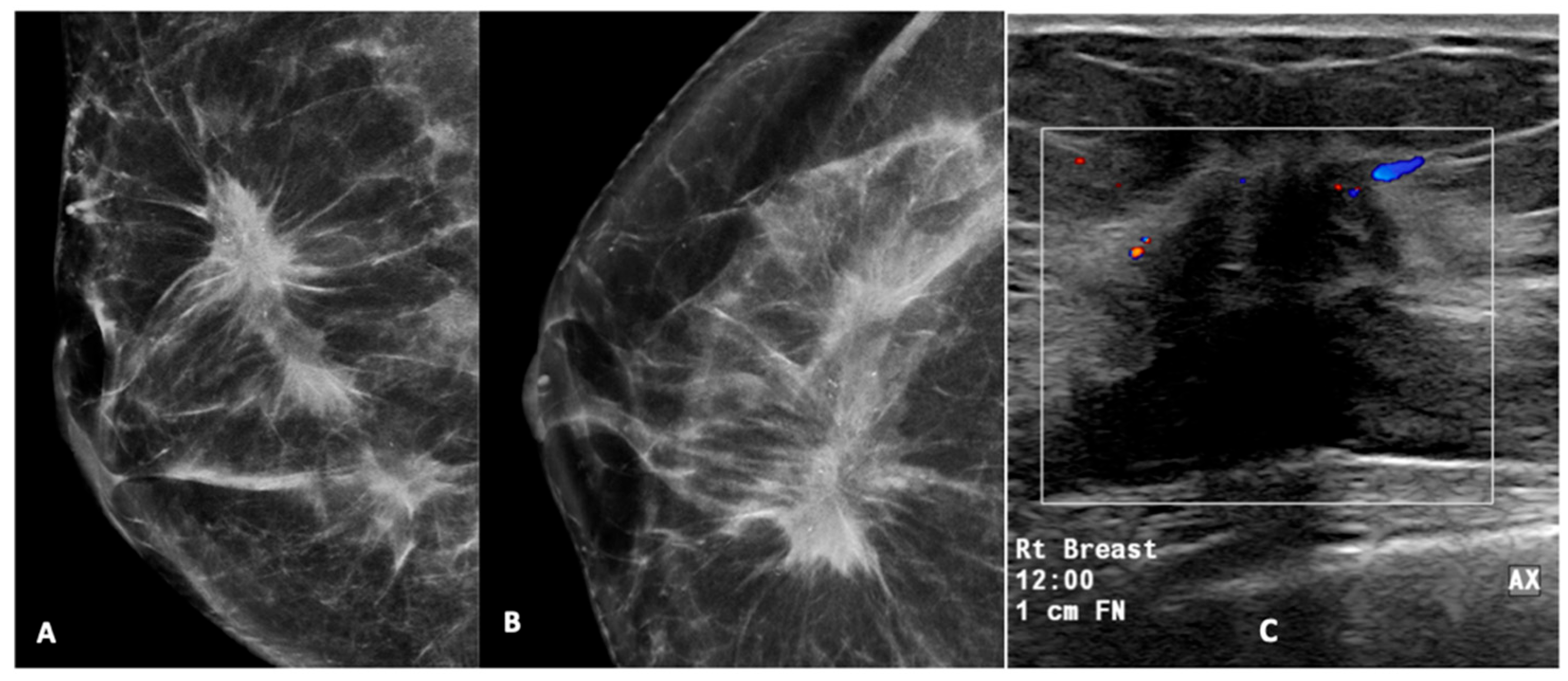 Diagnostics 15 01687 g006