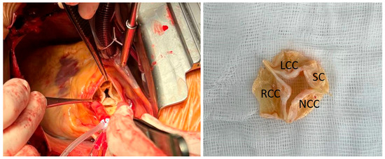 Diagnostics 15 01689 g002