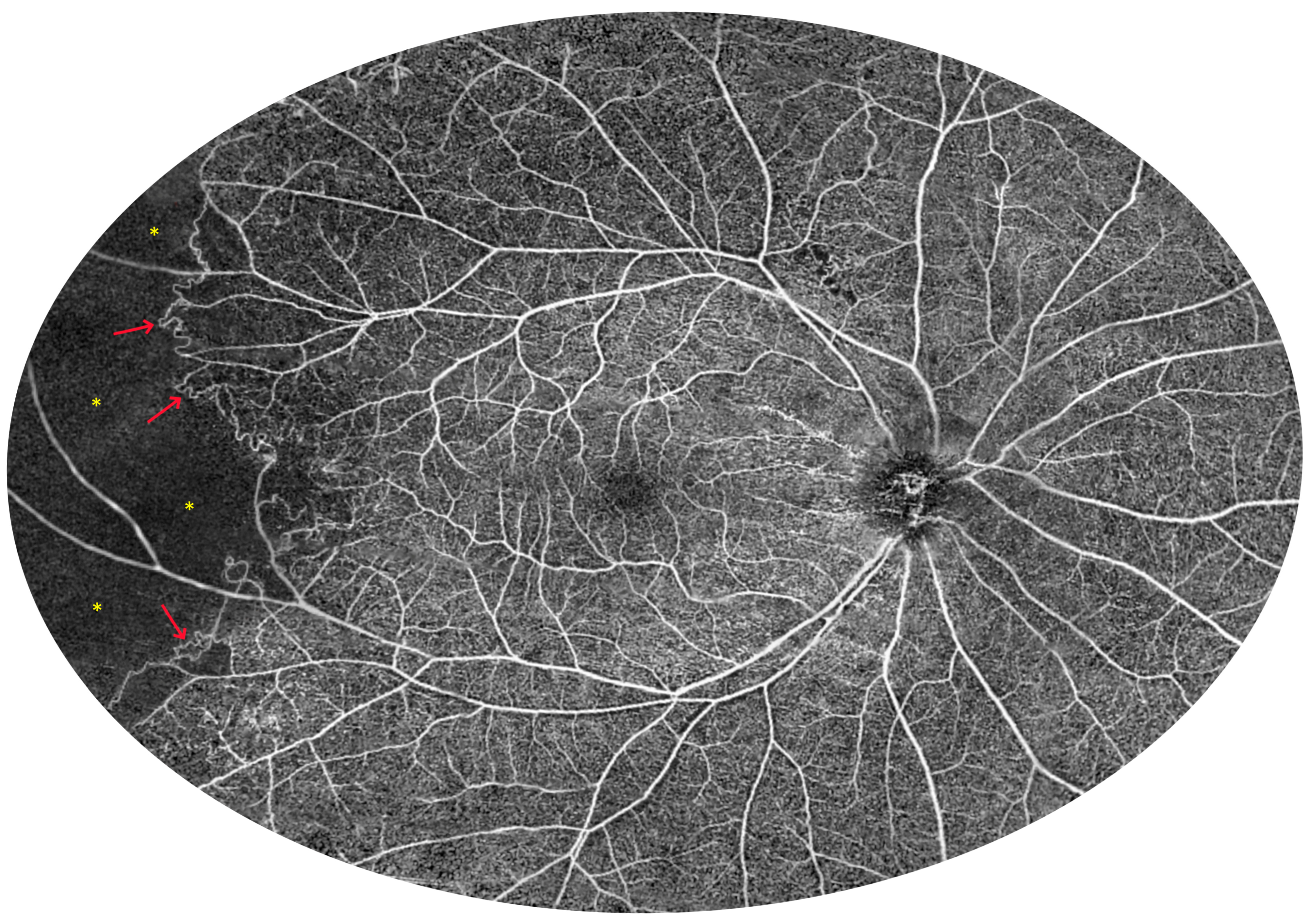 Diagnostics 15 01697 g016