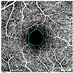 Diagnostics 15 01701 i004