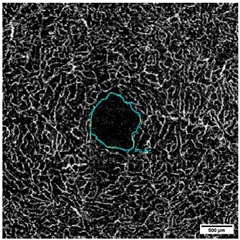 Diagnostics 15 01701 i005