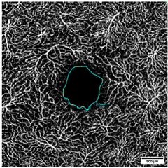 Diagnostics 15 01701 i006