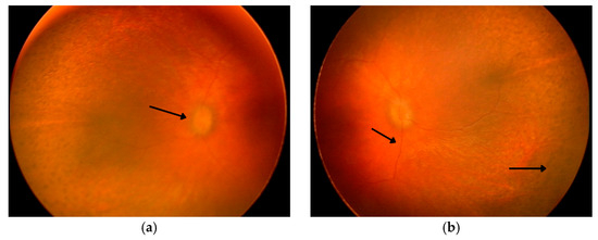 Diagnostics 15 01706 g002