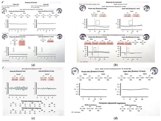 Diagnostics 15 01706 g003