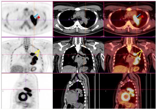 Diagnostics 15 01718 g002