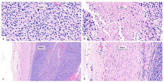 Diagnostics 15 01718 g004