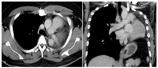 Diagnostics 15 01718 g005