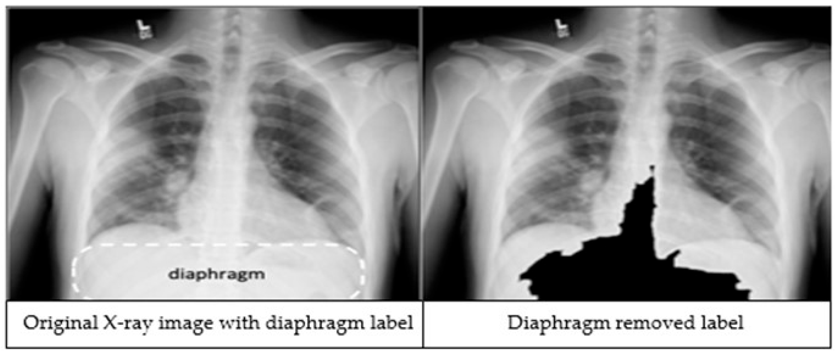 Diagnostics 15 01728 g002