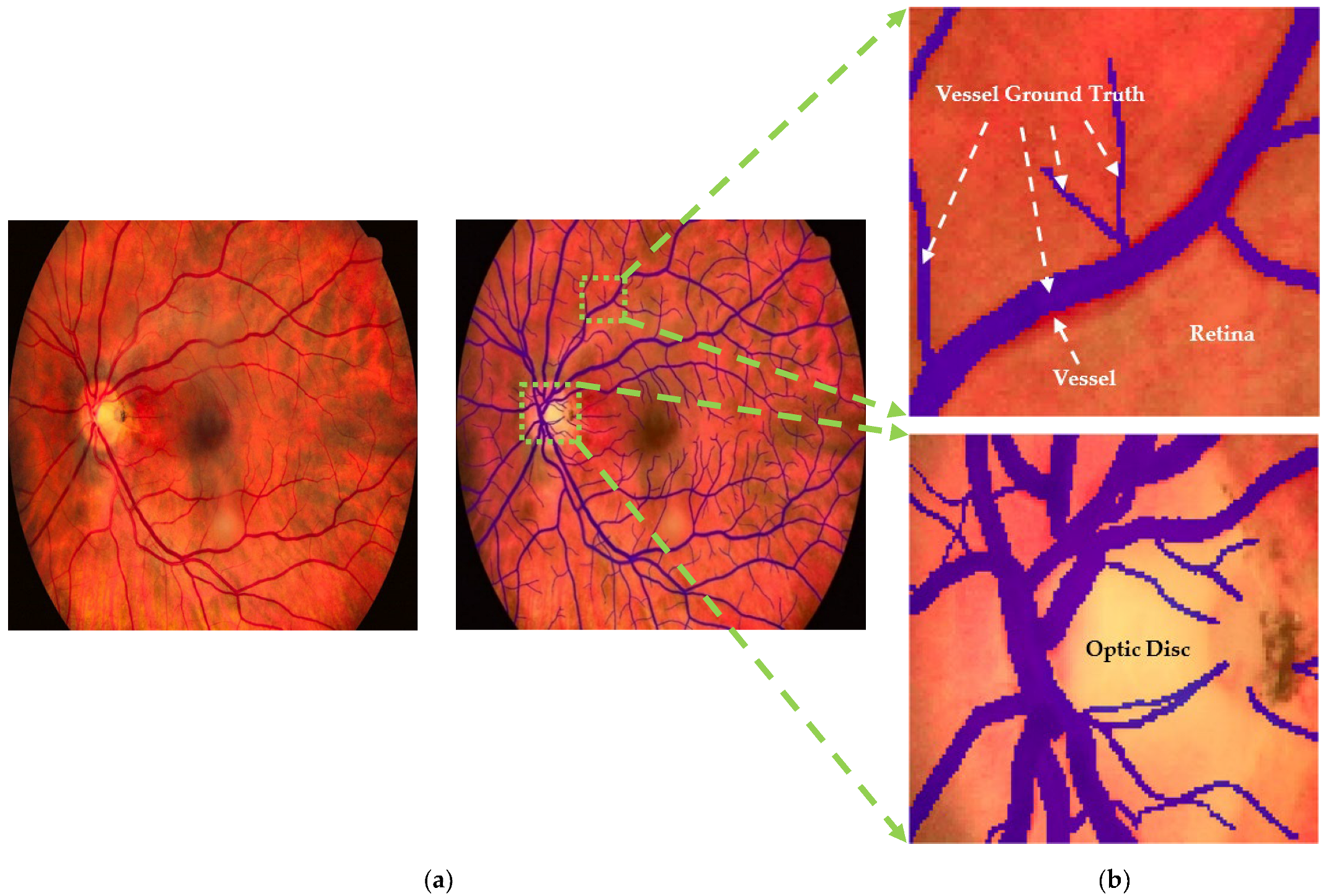 Diagnostics 15 01735 g005