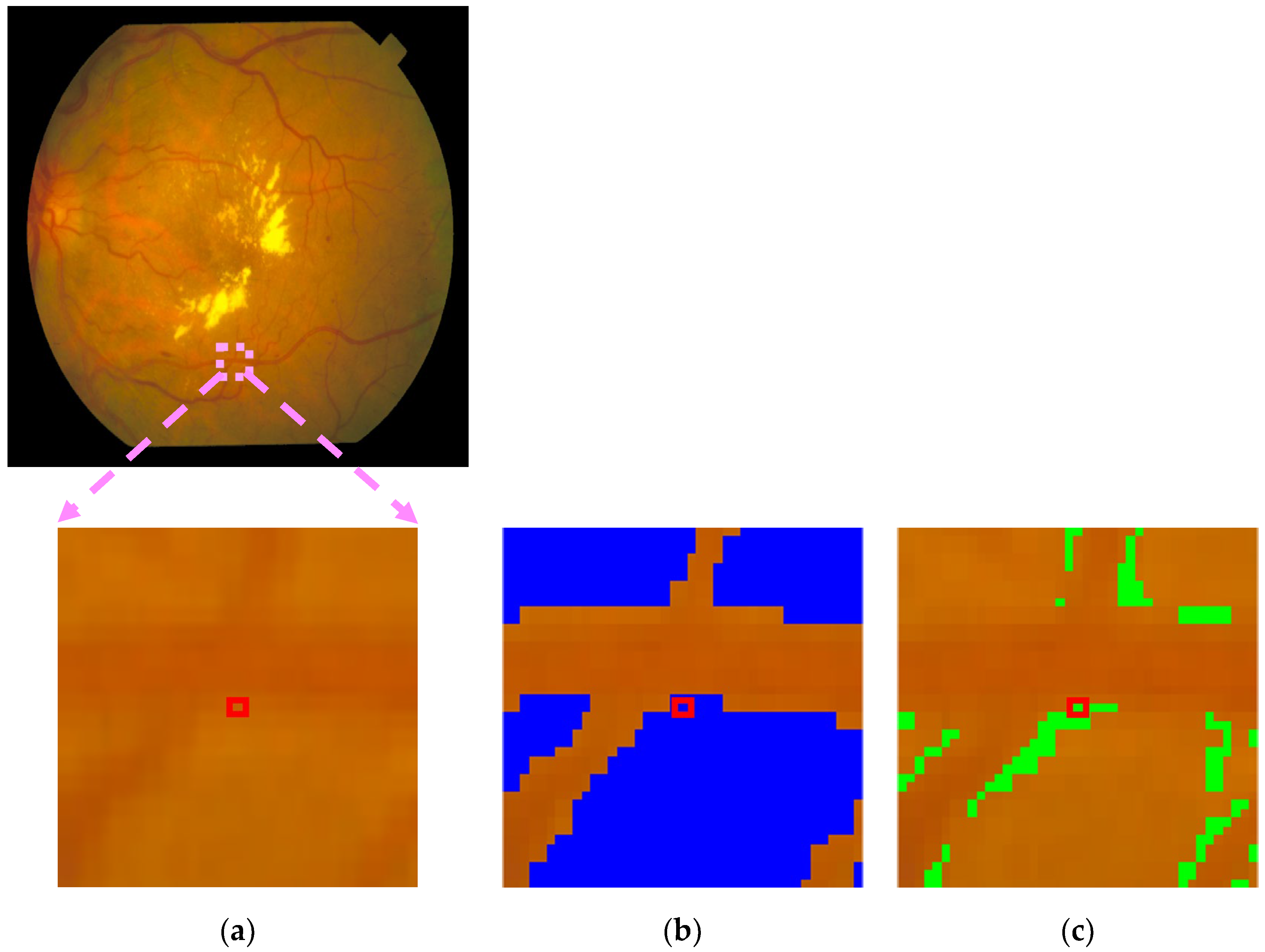 Diagnostics 15 01735 g011