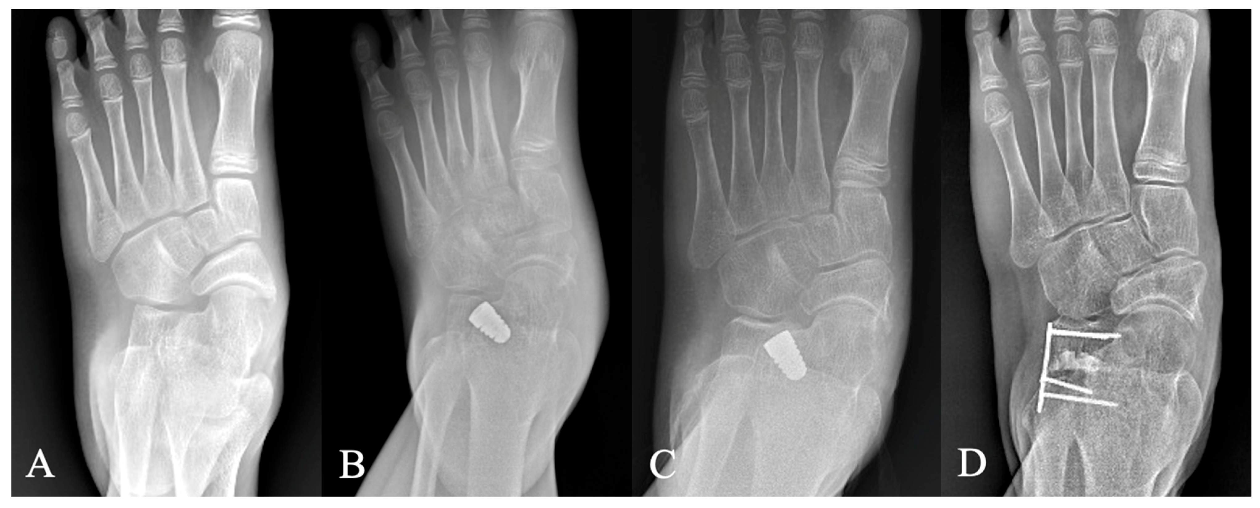 Diagnostics 15 01761 g005 Diagnostics 15 01761 g005