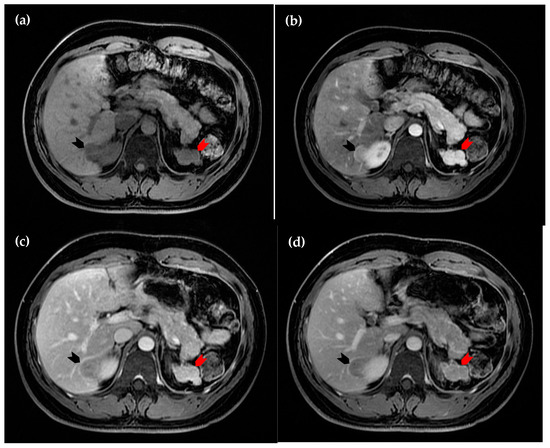 Diagnostics 15 01789 g003