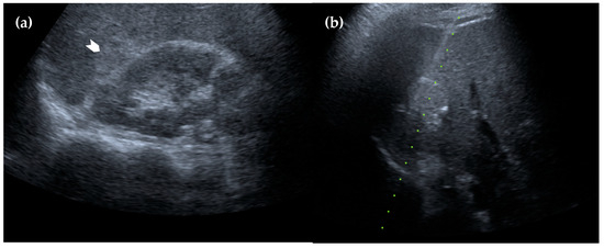 Diagnostics 15 01789 g004