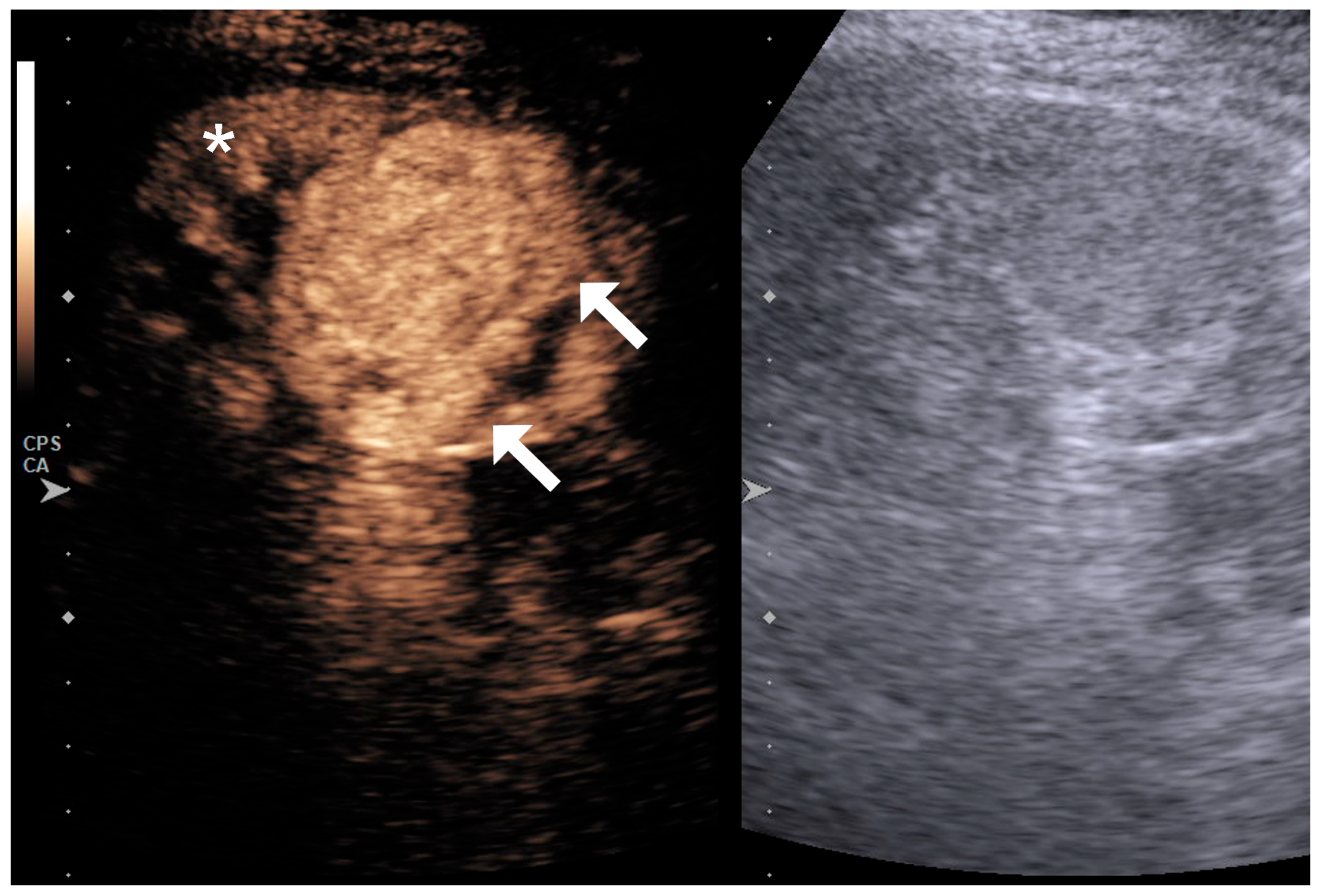 Diagnostics 15 01795 g001