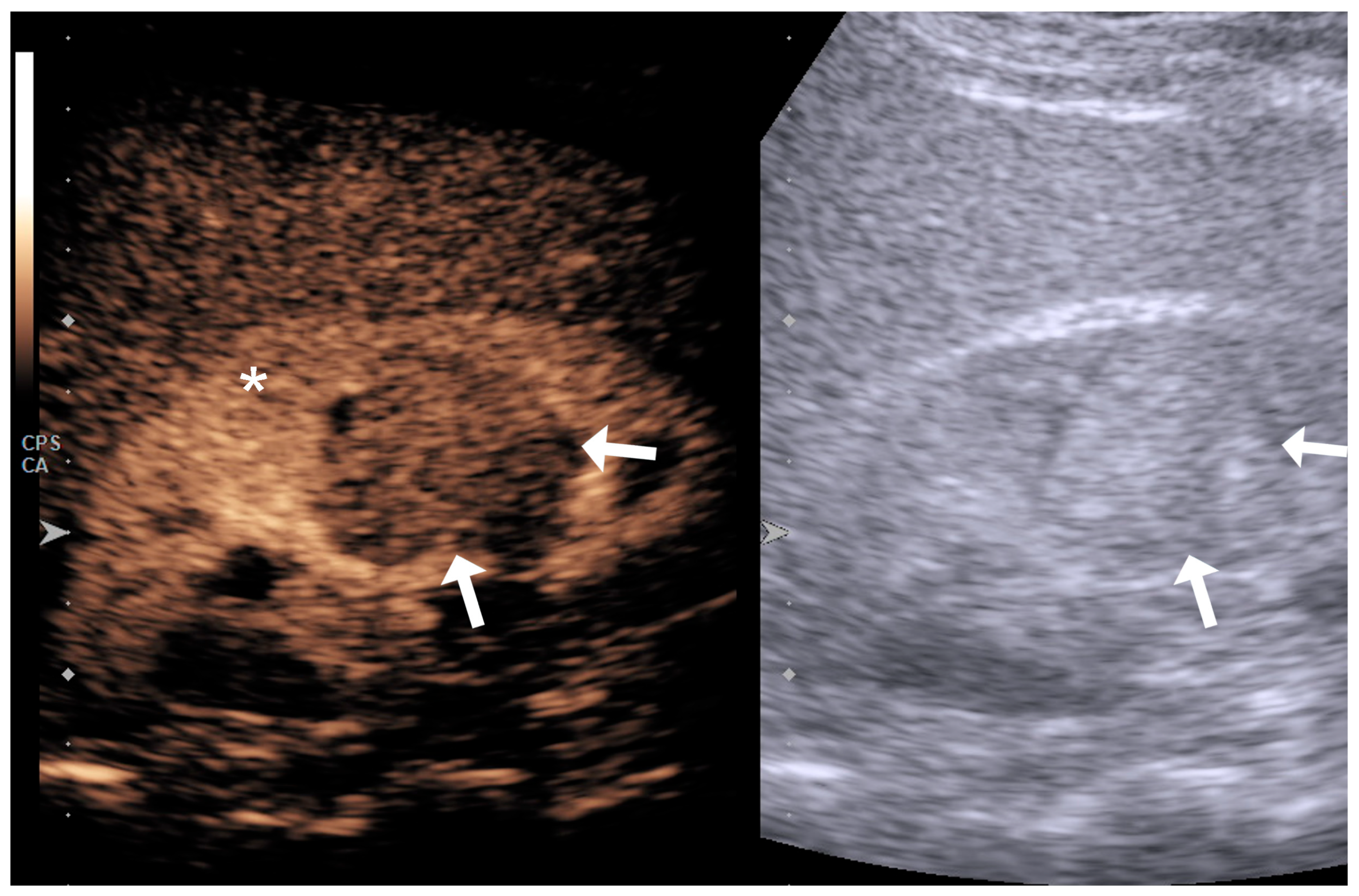 Diagnostics 15 01795 g003
