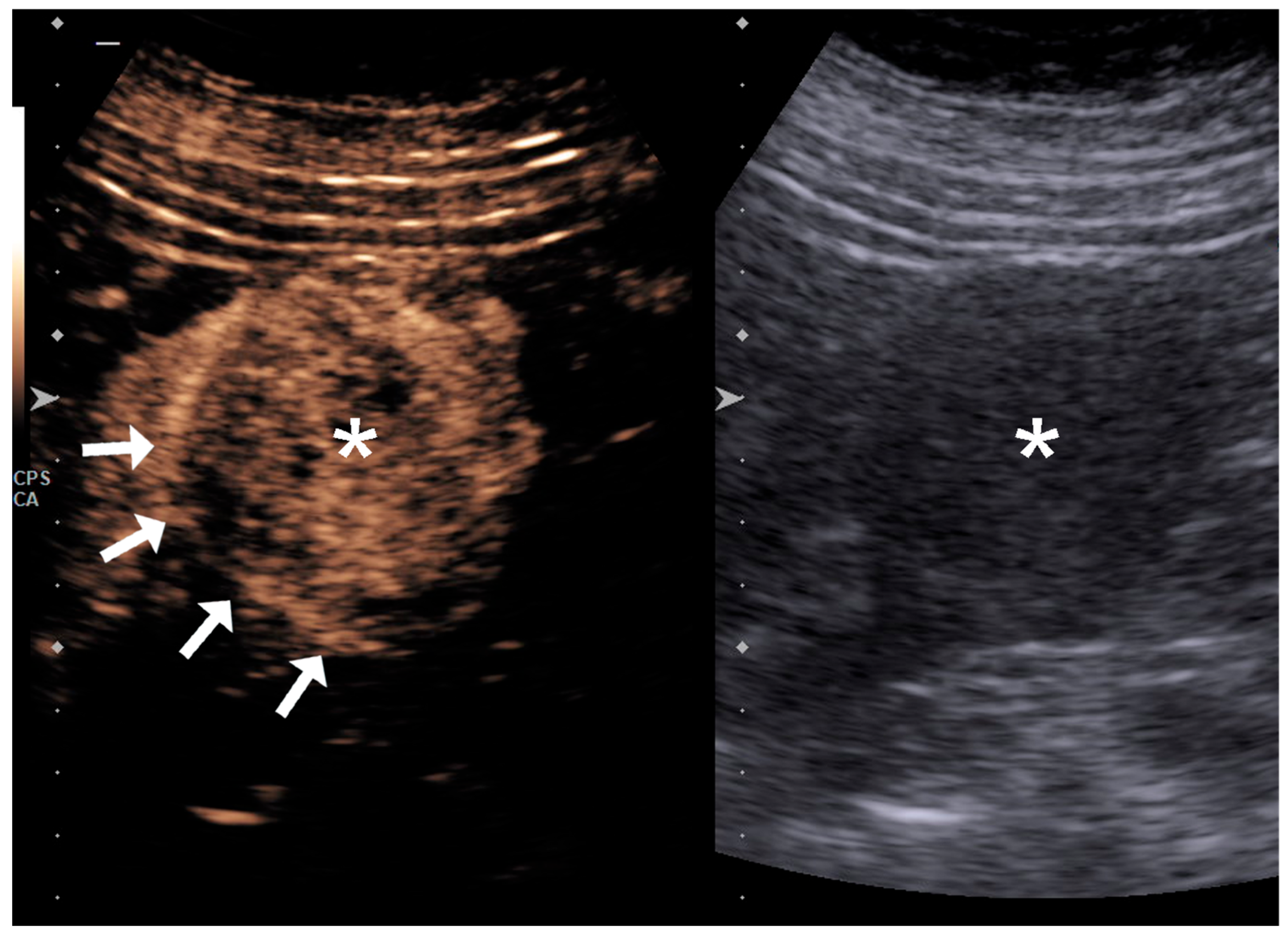 Diagnostics 15 01795 g004