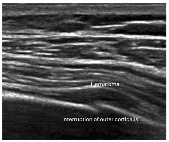 Diagnostics 15 01827 g005