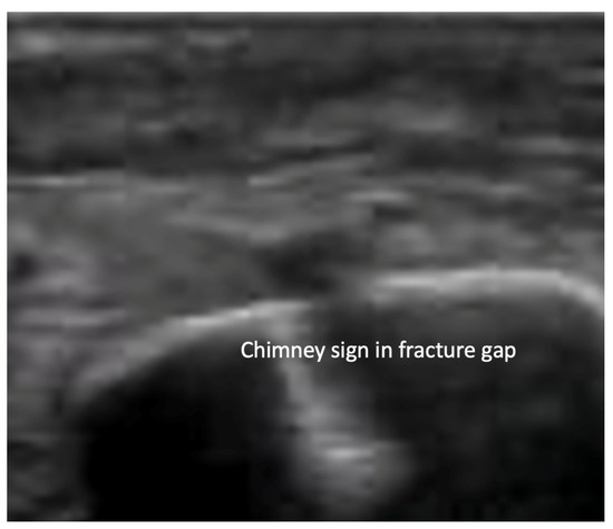 Diagnostics 15 01827 g006