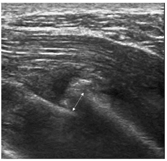 Diagnostics 15 01827 g007