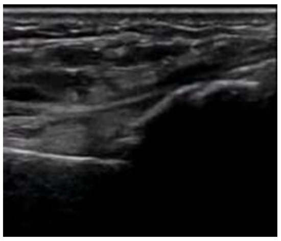 Diagnostics 15 01827 g008