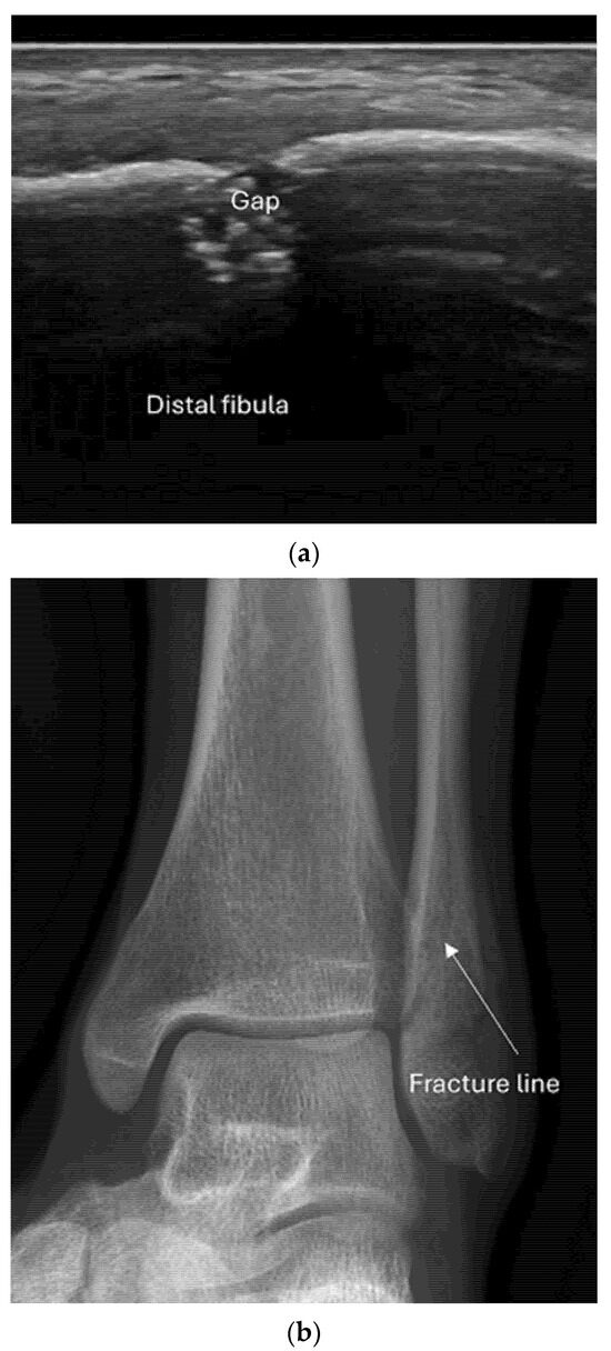 Diagnostics 15 01827 g009
