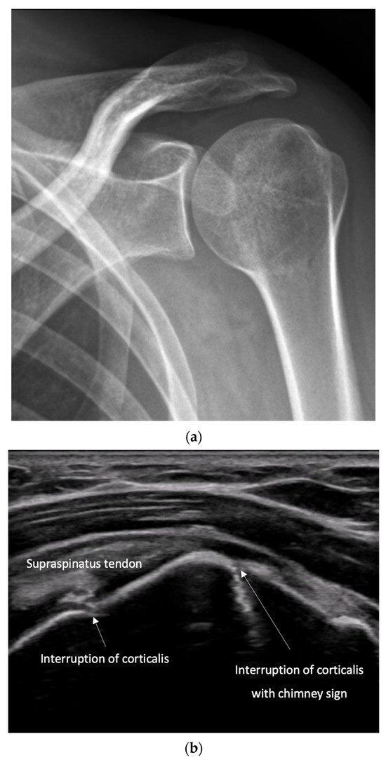 Diagnostics 15 01827 g010