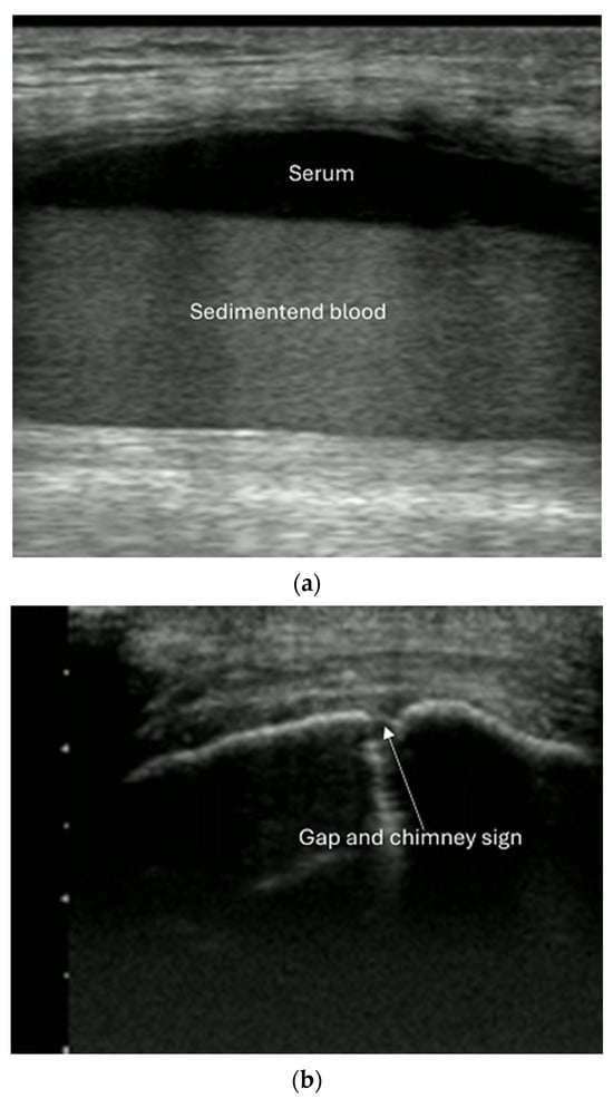 Diagnostics 15 01827 g011