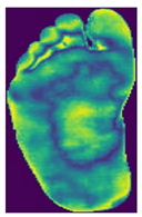 Diagnostics 15 01996 i005 Diagnostics 15 01996 i005