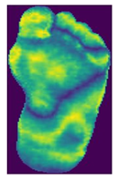 Diagnostics 15 01996 i006 Diagnostics 15 01996 i006