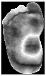 Diagnostics 15 01996 i009 Diagnostics 15 01996 i009