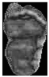 Diagnostics 15 01996 i013 Diagnostics 15 01996 i013