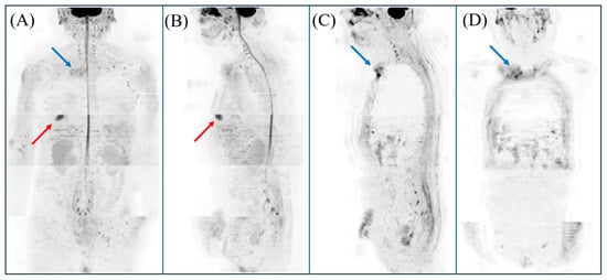 Diagnostics 15 02032 g001