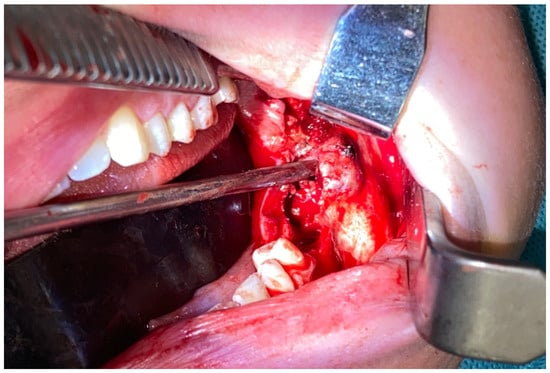 Diagnostics 15 02038 g002