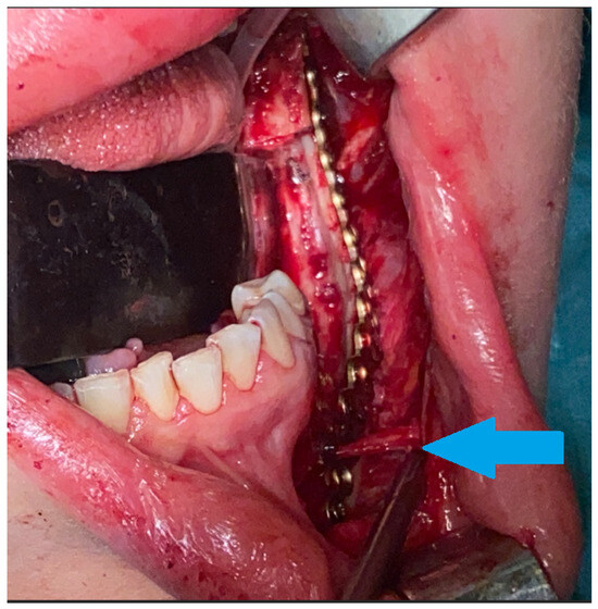 Diagnostics 15 02038 g003