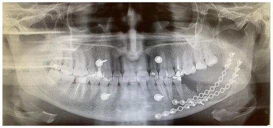 Diagnostics 15 02038 g004