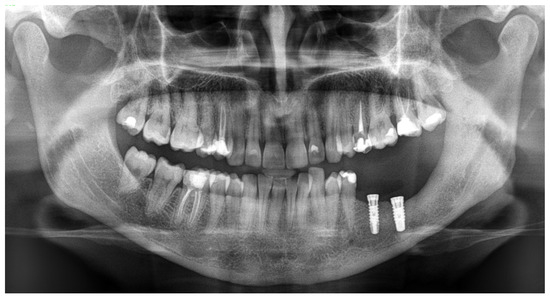 Diagnostics 15 02038 g007