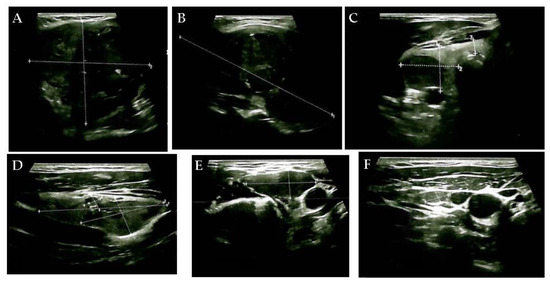Diagnostics 15 02049 g001