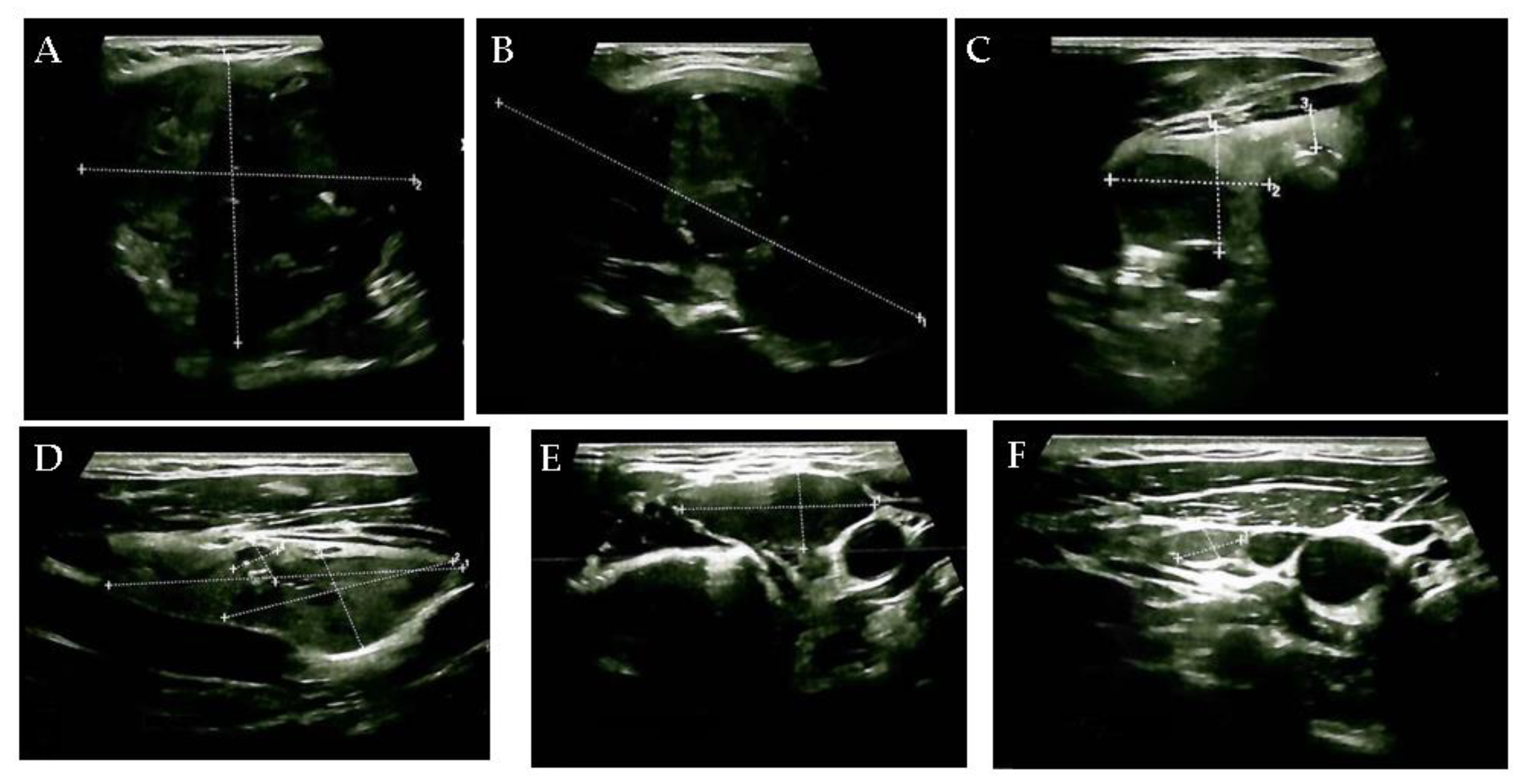 Diagnostics 15 02049 g001