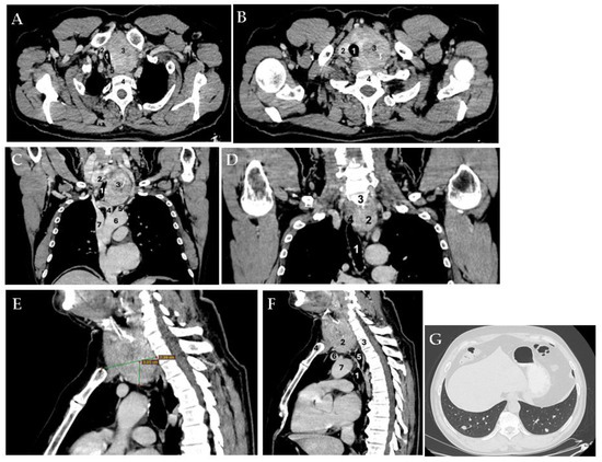 Diagnostics 15 02049 g002