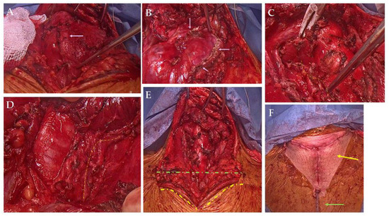 Diagnostics 15 02049 g003