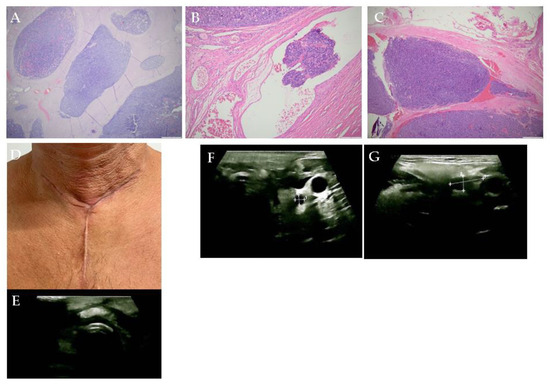 Diagnostics 15 02049 g004