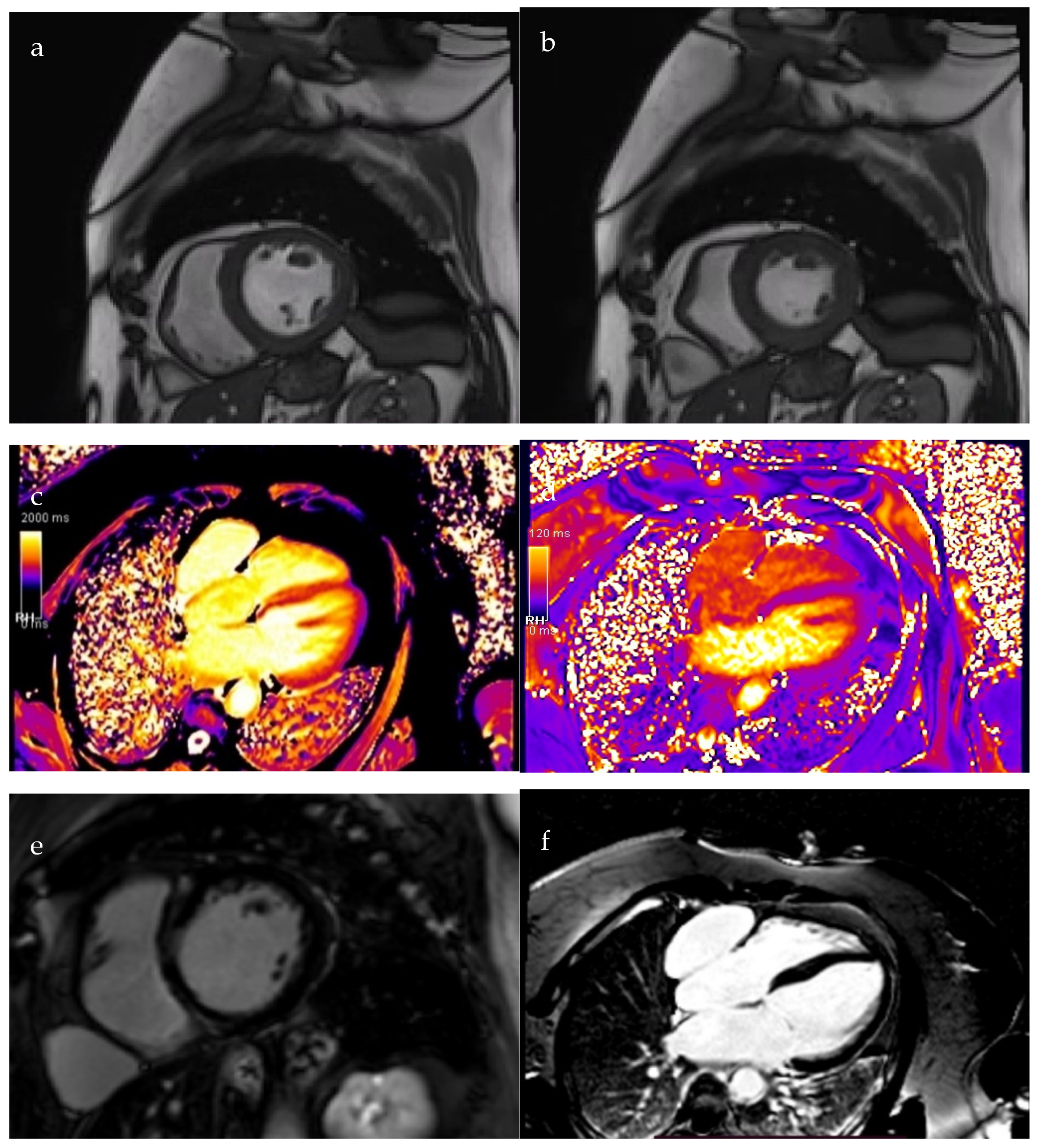 Diagnostics 15 02058 g003a